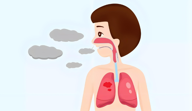 支气管哮喘的早期症状